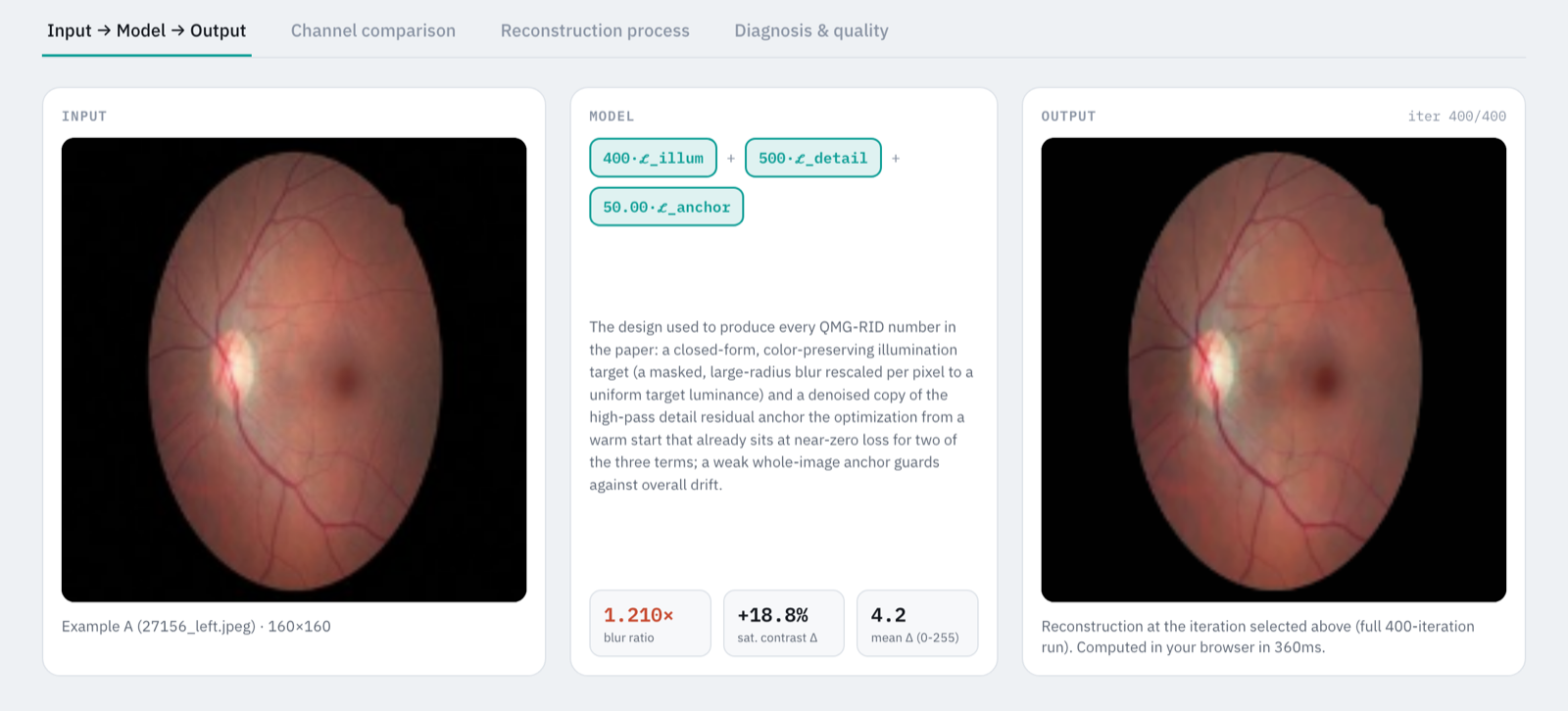 QMG-RID Explorer — Fundus Image Enhancement